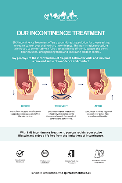image to show how EMS treatment works for female urinary incontinence Slough