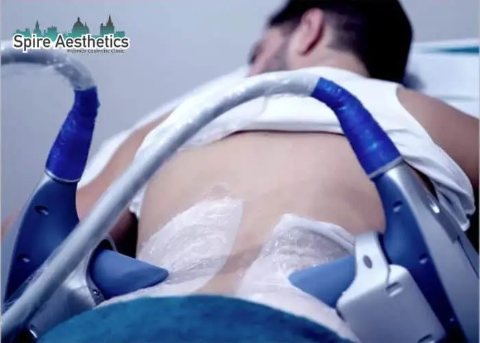 Man having fat freezing treatment done on love handles before a competitions Slough to create a sculpted look.