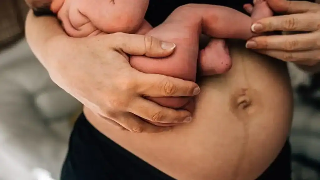 Why Is My Stomach Still Big After Pregnancy Slough?